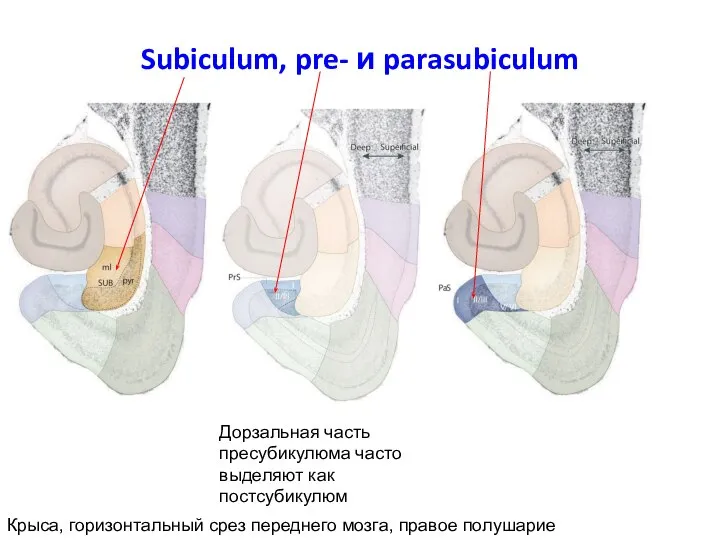 Subiculum, pre- и parasubiculum Крыса, горизонтальный срез переднего мозга, правое полушарие Дорзальная