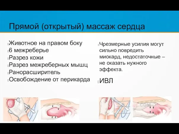 Прямой (открытый) массаж сердца Животное на правом боку 6 межреберье Разрез кожи