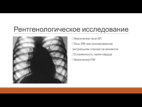 Рентгенологическое исследование Увеличение тени ЛП Тень ЛЖ при изолированном митральном стенозе не