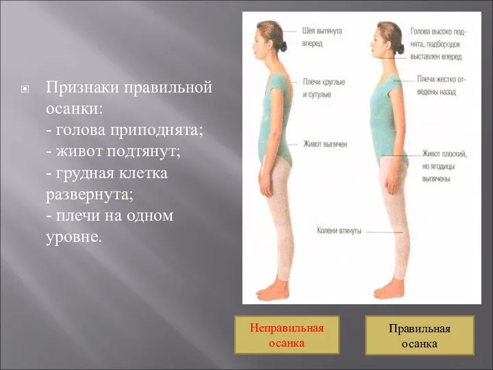 Признаки правильной осанки: - голова приподнята; - живот подтянут; - грудная клетка