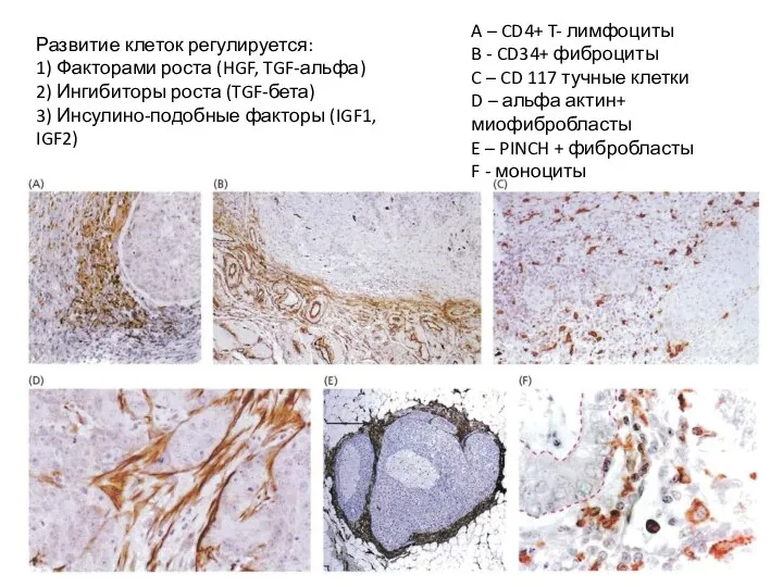 A – CD4+ T- лимфоциты B - CD34+ фиброциты C – CD