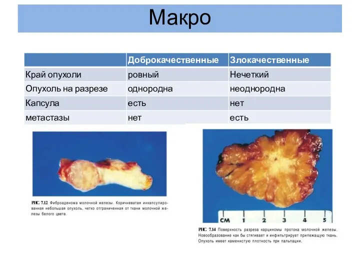 Макро