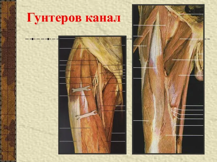 Гунтеров канал