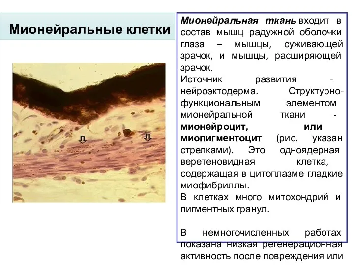 Мионейральные клетки Мионейральная ткань входит в состав мышц радужной оболочки глаза –