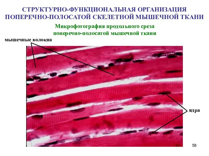 Микрофотография продольного среза поперечно-полосатой мышечной ткани мышечные волокна ядра СТРУКТУРНО-ФУНКЦИОНАЛЬНАЯ ОРГАНИЗАЦИЯ ПОПЕРЕЧНО-ПОЛОСАТОЙ СКЕЛЕТНОЙ МЫШЕЧНОЙ ТКАНИ