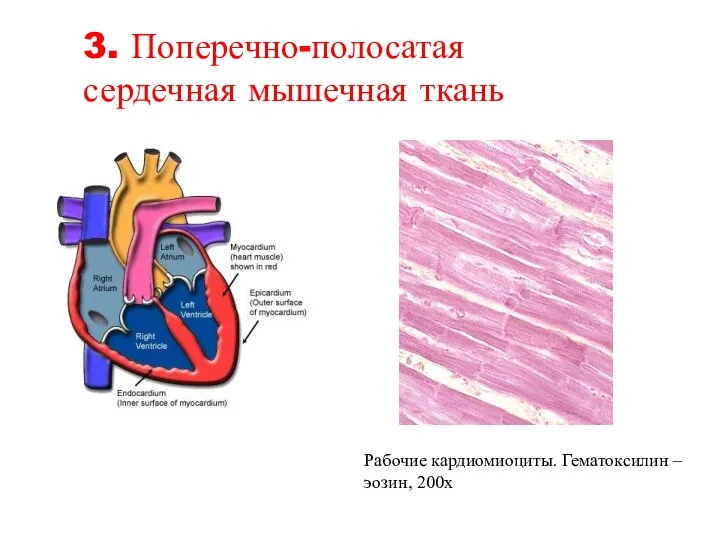 Рабочие кардиомиоциты. Гематоксилин – эозин, 200х 3. Поперечно-полосатая сердечная мышечная ткань