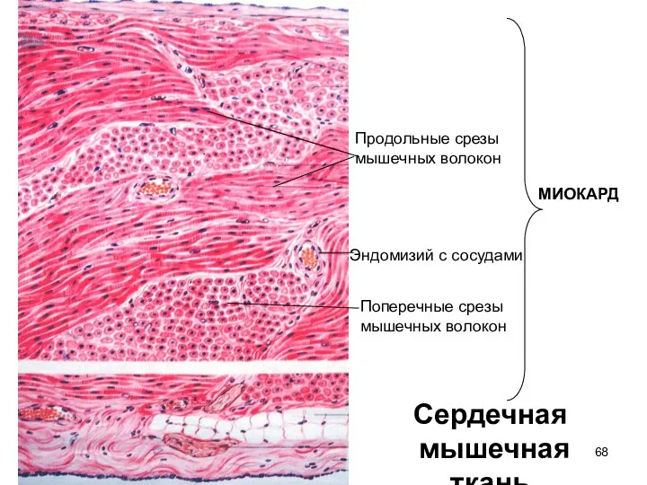 Сердечная мышечная ткань Продольные срезы мышечных волокон Поперечные срезы мышечных волокон Эндомизий с сосудами МИОКАРД