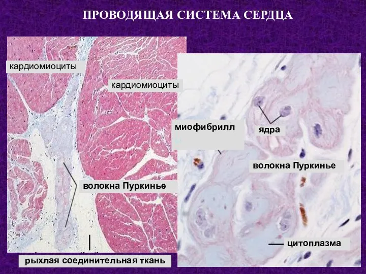 ПРОВОДЯЩАЯ СИСТЕМА СЕРДЦА кардиомиоциты кардиомиоциты волокна Пуркинье рыхлая соединительная ткань ядра волокна Пуркинье цитоплазма миофибриллы