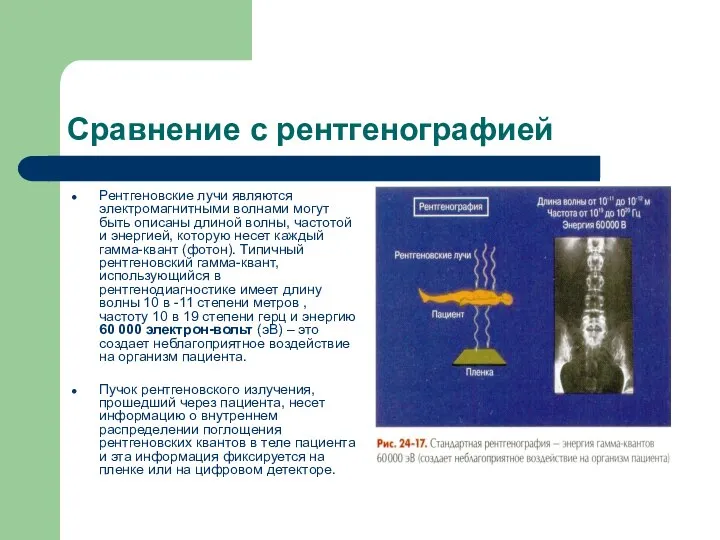 Сравнение с рентгенографией Рентгеновские лучи являются электромагнитными волнами могут быть описаны длиной