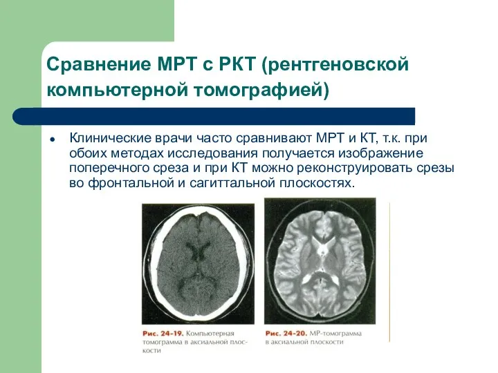 Сравнение МРТ с РКТ (рентгеновской компьютерной томографией) Клинические врачи часто сравнивают МРТ