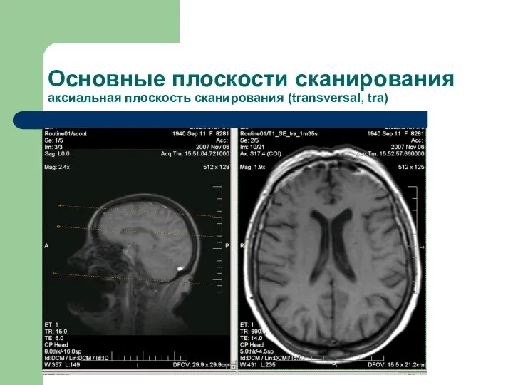 Основные плоскости сканирования аксиальная плоскость сканирования (transversal, tra)