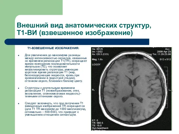 Внешний вид анатомических структур, Т1-ВИ (взвешенное изображение) Т1-ВЗВЕШЕННЫЕ ИЗОБРАЖЕНИЯ: Для увеличения до