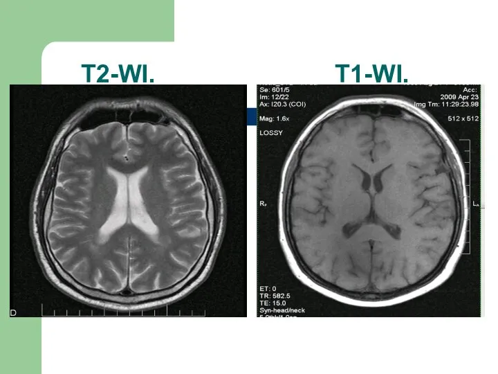 Т2-WI. Т1-WI.