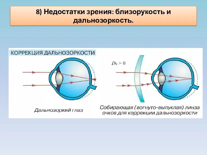 8) Недостатки зрения: близорукость и дальнозоркость.