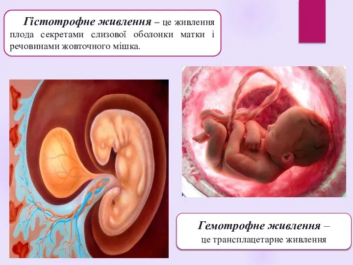 Гемотрофне живлення – це трансплацетарне живлення. Гістотрофне живлення – це живлення плода