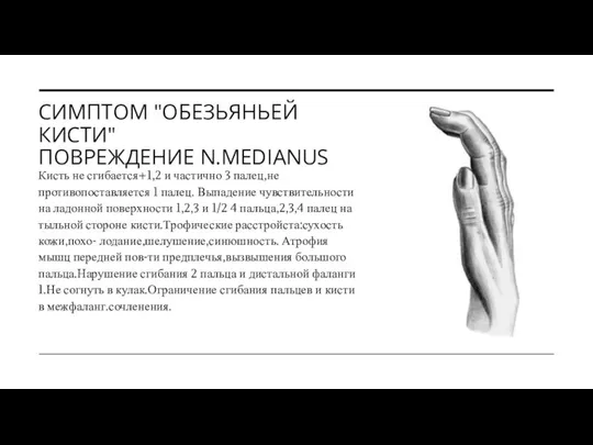 СИМПТОМ "ОБЕЗЬЯНЬЕЙ КИСТИ" ПОВРЕЖДЕНИЕ N.MEDIANUS Кисть не сгибается+1,2 и частично 3 палец,не