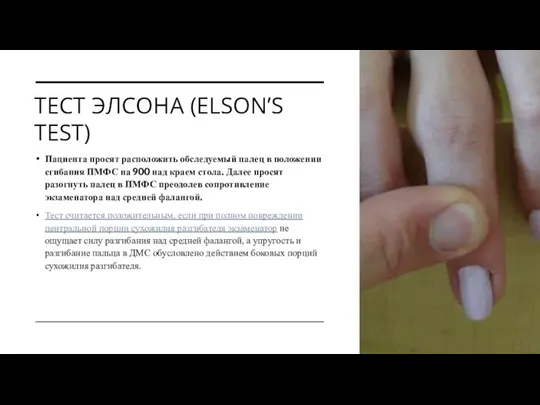 ТЕСТ ЭЛСОНА (ELSON’S TEST) Пациента просят расположить обследуемый палец в положении сгибания