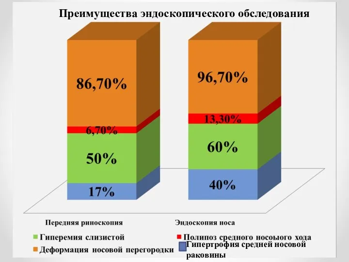 Преимущества эндоскопического обследования Гипертрофия средней носовой раковины