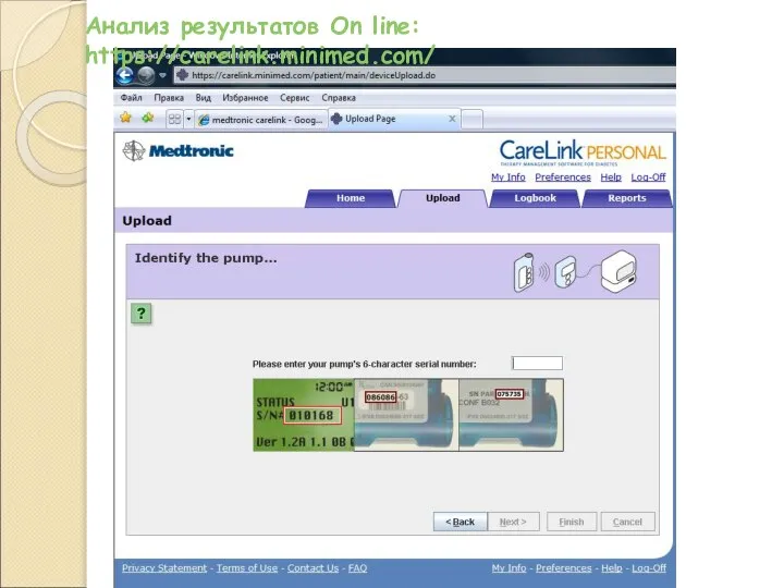Анализ результатов On line: https://carelink.minimed.com/