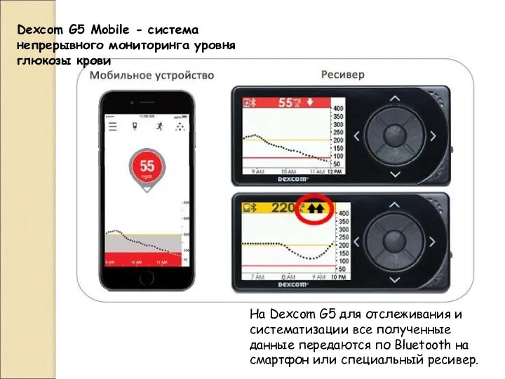 Dexcom G5 Mobile - система непрерывного мониторинга уровня глюкозы крови На Dexcom