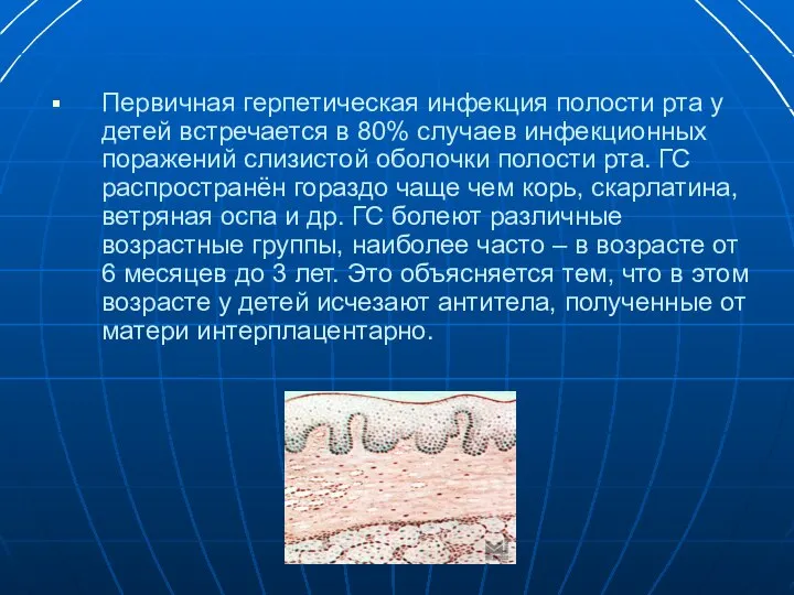 Первичная герпетическая инфекция полости рта у детей встречается в 80% случаев инфекционных