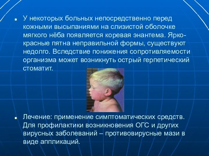 У некоторых больных непосредственно перед кожными высыпаниями на слизистой оболочке мягкого нёба