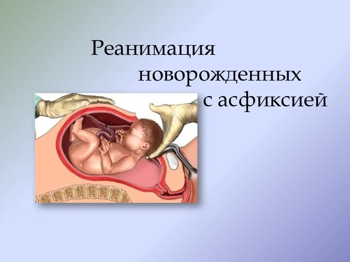 Реанимация новорожденных с асфиксией