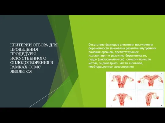 КРИТЕРИИ ОТБОРА ДЛЯ ПРОВЕДЕНИЯ ПРОЦЕДУРЫ ИСКУСТВЕННОГО ОПЛОДОТВОРЕНИЯ В РАМКАХ ОСМС ЯВЛЯЕТСЯ Отсутствие