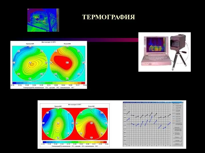 ТЕРМОГРАФИЯ