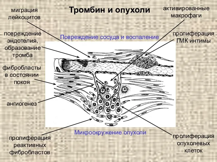 Тромбин и опухоли