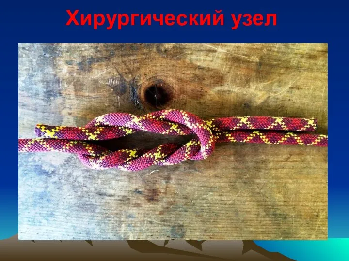 Хирургический узел