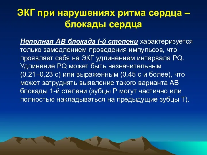 ЭКГ при нарушениях ритма сердца – блокады сердца Неполная АВ блокада I-й