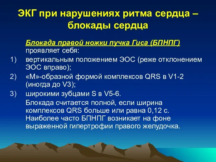 ЭКГ при нарушениях ритма сердца – блокады сердца Блокада правой ножки пучка