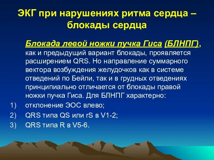 ЭКГ при нарушениях ритма сердца – блокады сердца Блокада левой ножки пучка