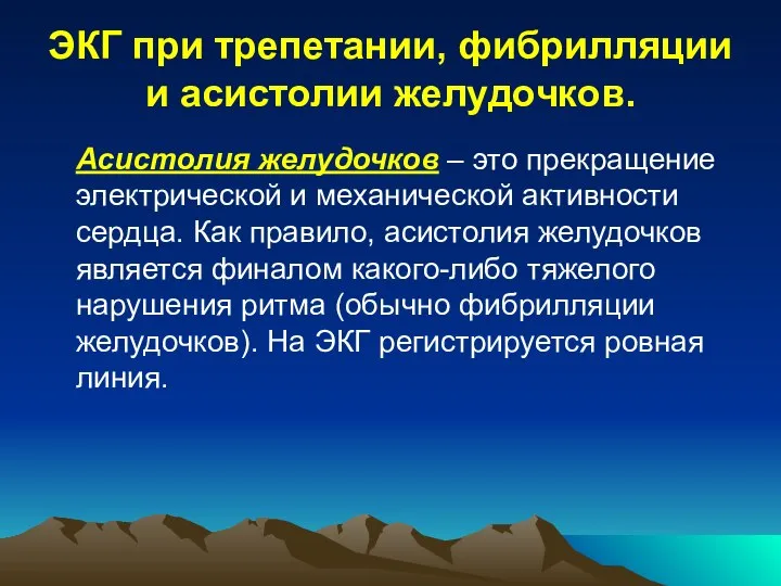 ЭКГ при трепетании, фибрилляции и асистолии желудочков. Асистолия желудочков – это прекращение