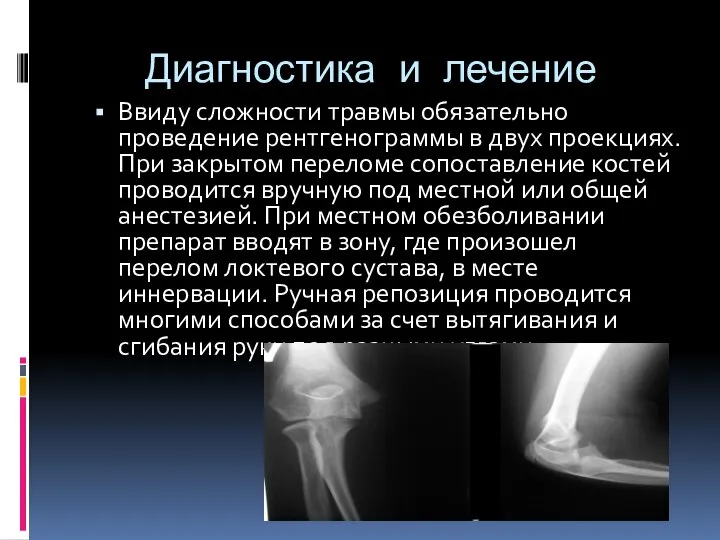 Диагностика и лечение Ввиду сложности травмы обязательно проведение рентгенограммы в двух проекциях.