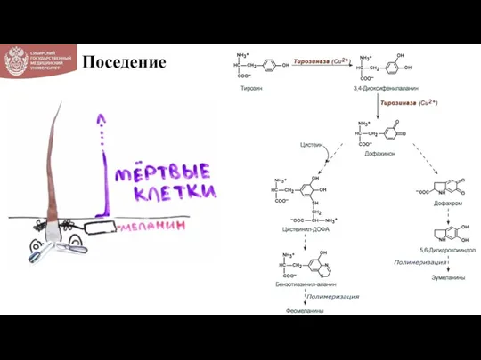 Поседение