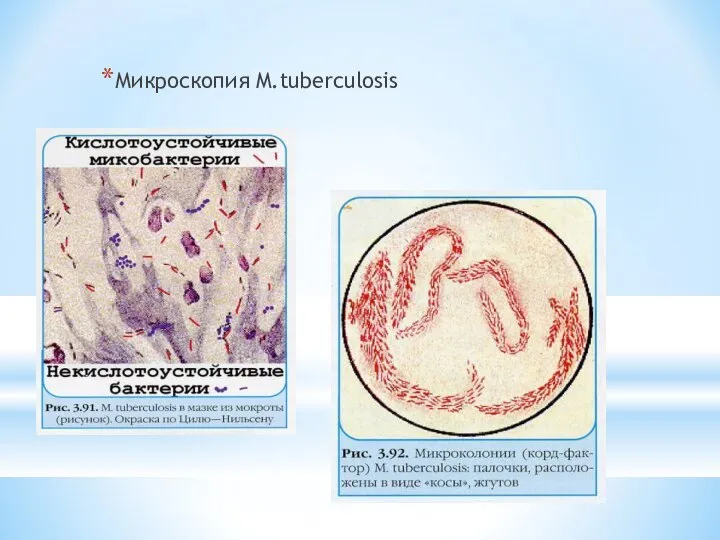 Микроскопия M.tuberculоsis