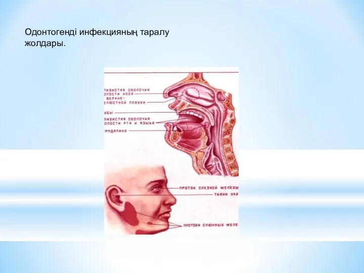 Одонтогенді инфекцияның таралу жолдары.