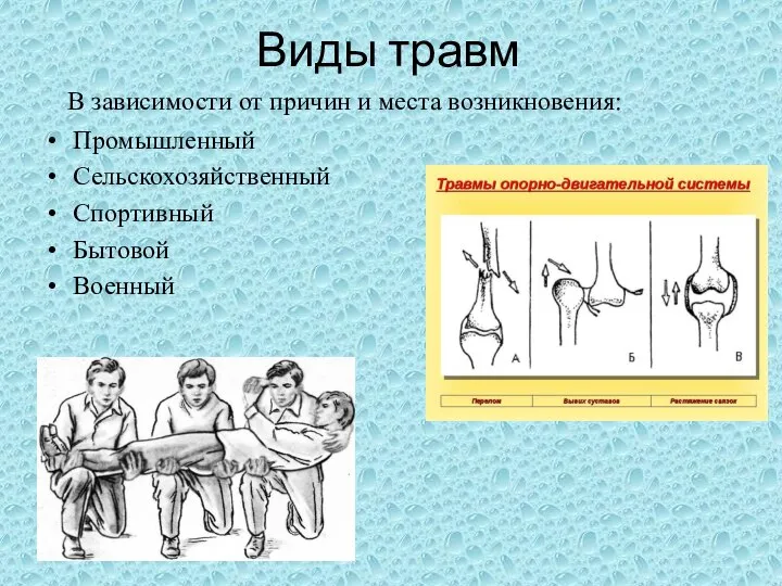 Виды травм В зависимости от причин и места возникновения: Промышленный Сельскохозяйственный Спортивный Бытовой Военный