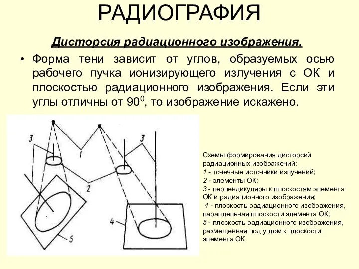 РАДИОГРАФИЯ Дисторсия радиационного изображения. Форма тени зависит от углов, образуемых осью рабочего