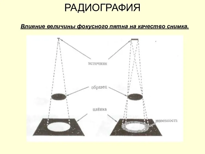 РАДИОГРАФИЯ Влияние величины фокусного пятна на качество снимка.