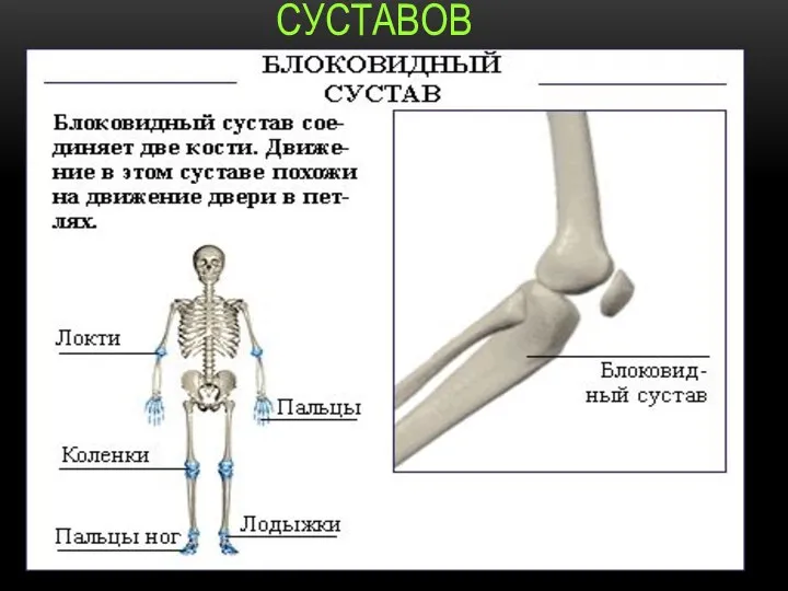 ВИДЫ СУСТАВОВ