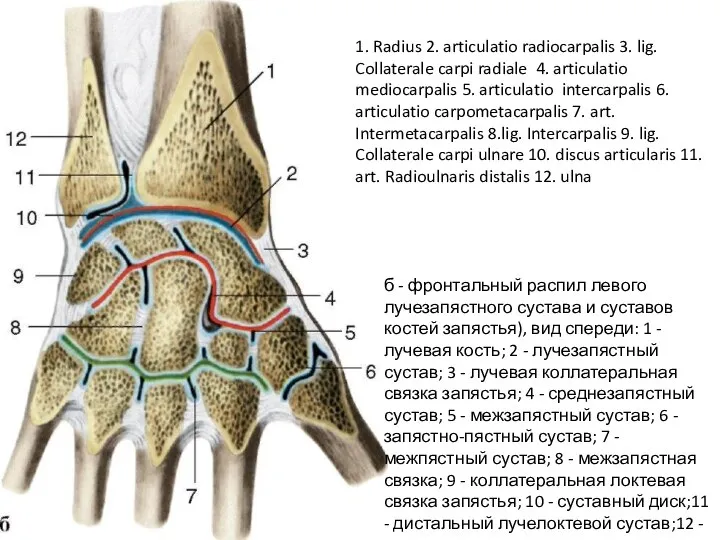 б - фронтальный распил левого лучезапястного сустава и суставов костей запястья), вид