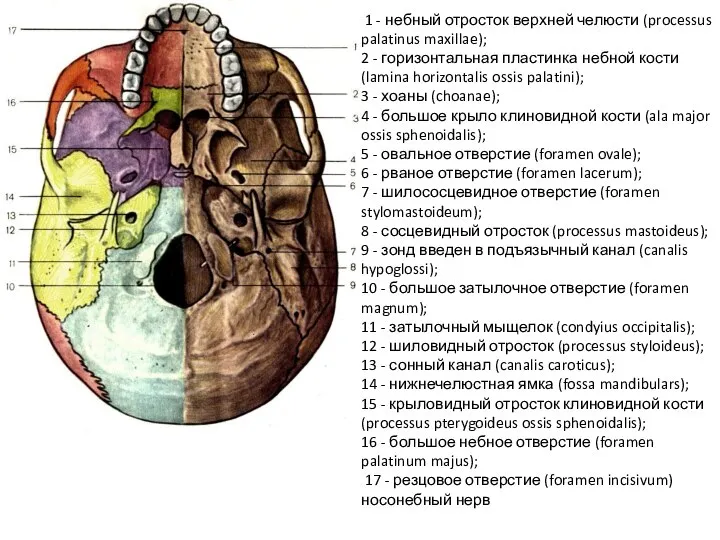 1 - небный отросток верхней челюсти (processus palatinus maxillae); 2 - горизонтальная