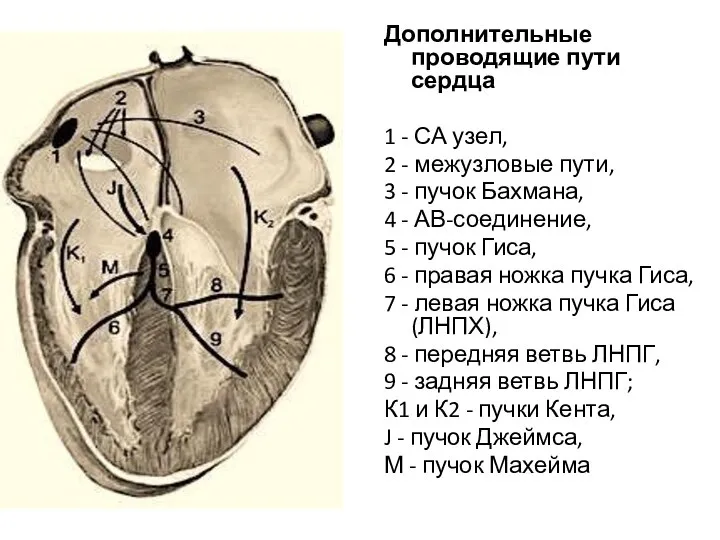 Дополнительные проводящие пути сердца 1 - СА узел, 2 - межузловые пути,