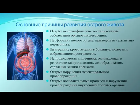 Основные причины развития острого живота Острые неспецифические воспалительные заболевания органов пищеварения. Перфорация