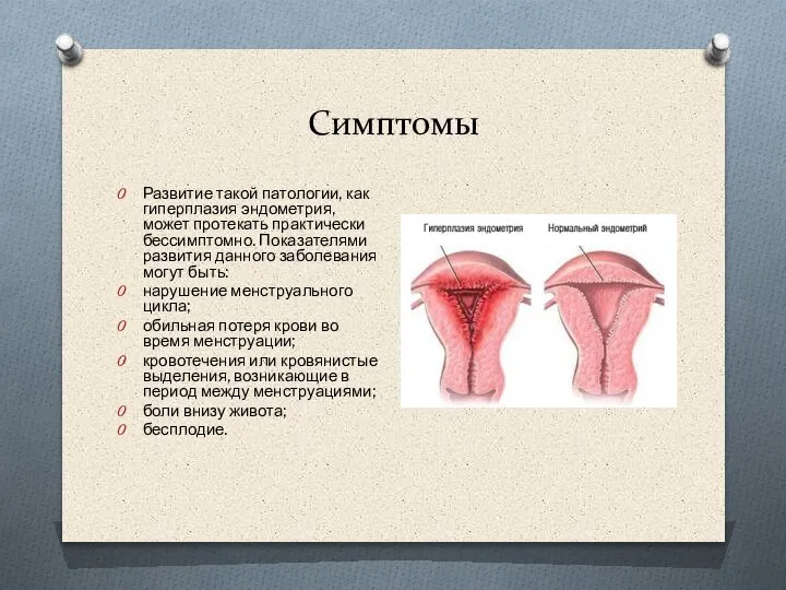 Симптомы Развитие такой патологии, как гиперплазия эндометрия, может протекать практически бессимптомно. Показателями