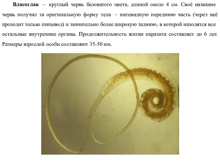 Власоглав – круглый червь беловатого цвета, длиной около 4 см. Своё название