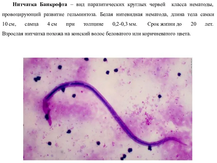 Нитчатка Банкрофта – вид паразитических круглых червей класса нематоды, провоцирующий развитие гельминтоза.